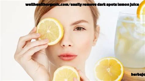 wellhealthorganic.com/easily-remove-dark-spots-lemon-juice|Wellhealthorganic.com: Easily Remove Dark Spots Lemon Juice